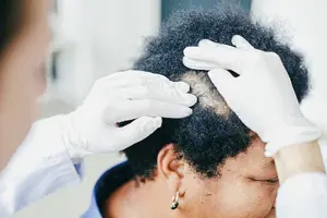 Dermatology care for hair loss and scalp conditions
