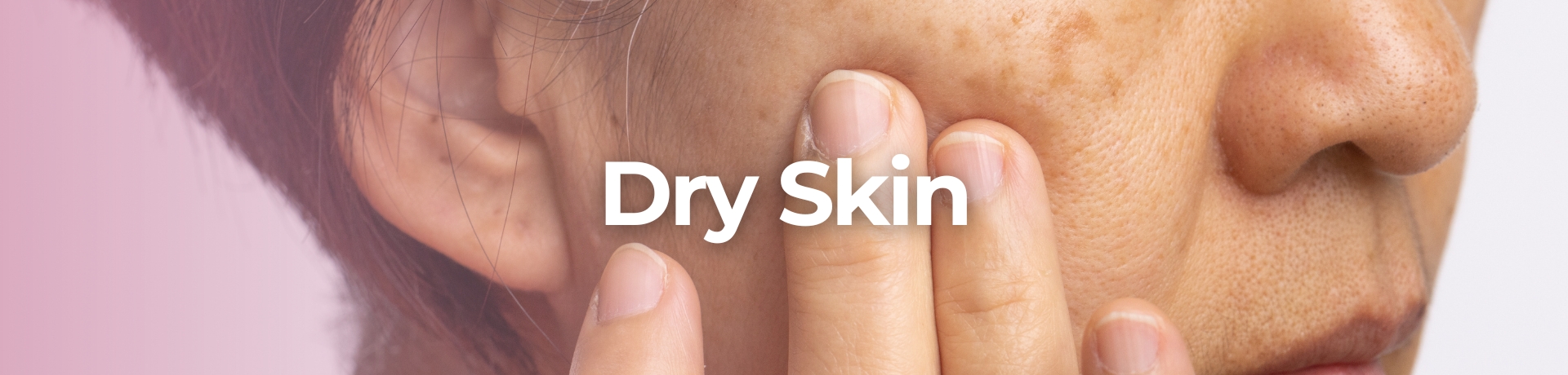 Dry Skin
