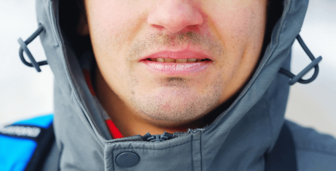 man with dried lips