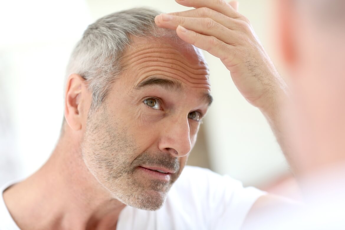 Man checking his hair scalp