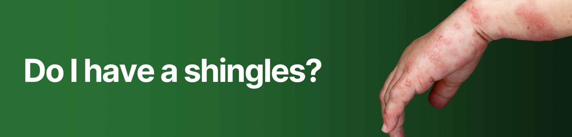 Do I have shingles?