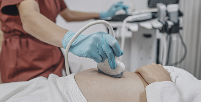 woman getting an ultrasound