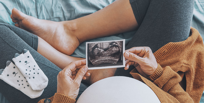 woman looking at an ultrasound